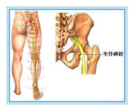 屁股疼痛是什么原因引起的