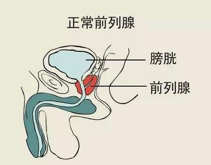 前列腺炎有什么症状