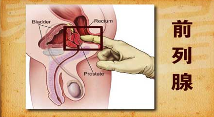 男性前列腺炎有什么症状