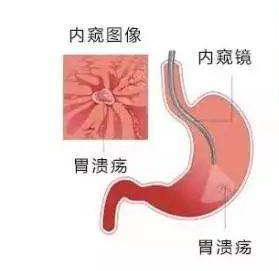 上海做胃镜检查多少钱