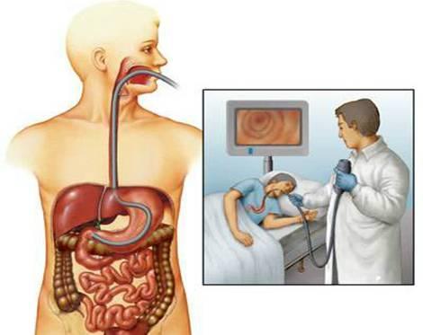 做胃镜前注意事