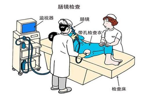 做肠镜前的准备工作有哪些